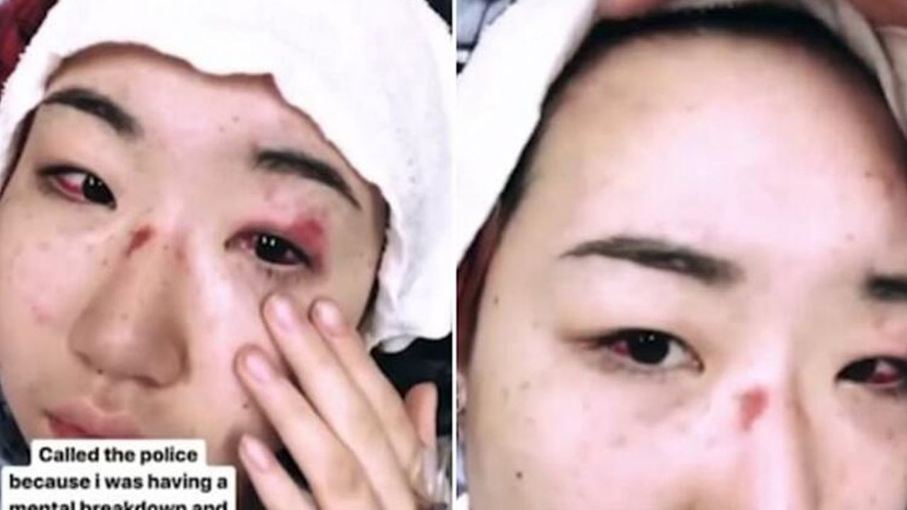 Kapıyı açtı, dehşeti yaşadı! - Sayfa 14