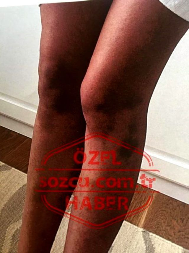 Ozan Güven'in Deniz Bulutsuz'u darbına dair yeni görüntüler ortaya çıktı - Sayfa 6