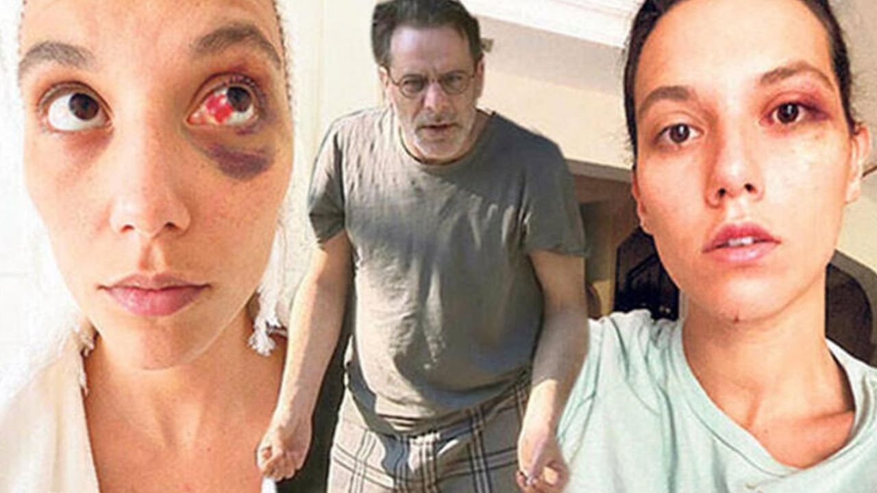 Ozan Güven villasını terk etti! - Sayfa 6