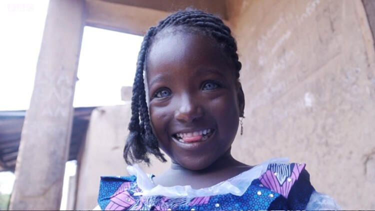 Mavi gözleri yüzünden kocası evden kovdu! - Sayfa 7