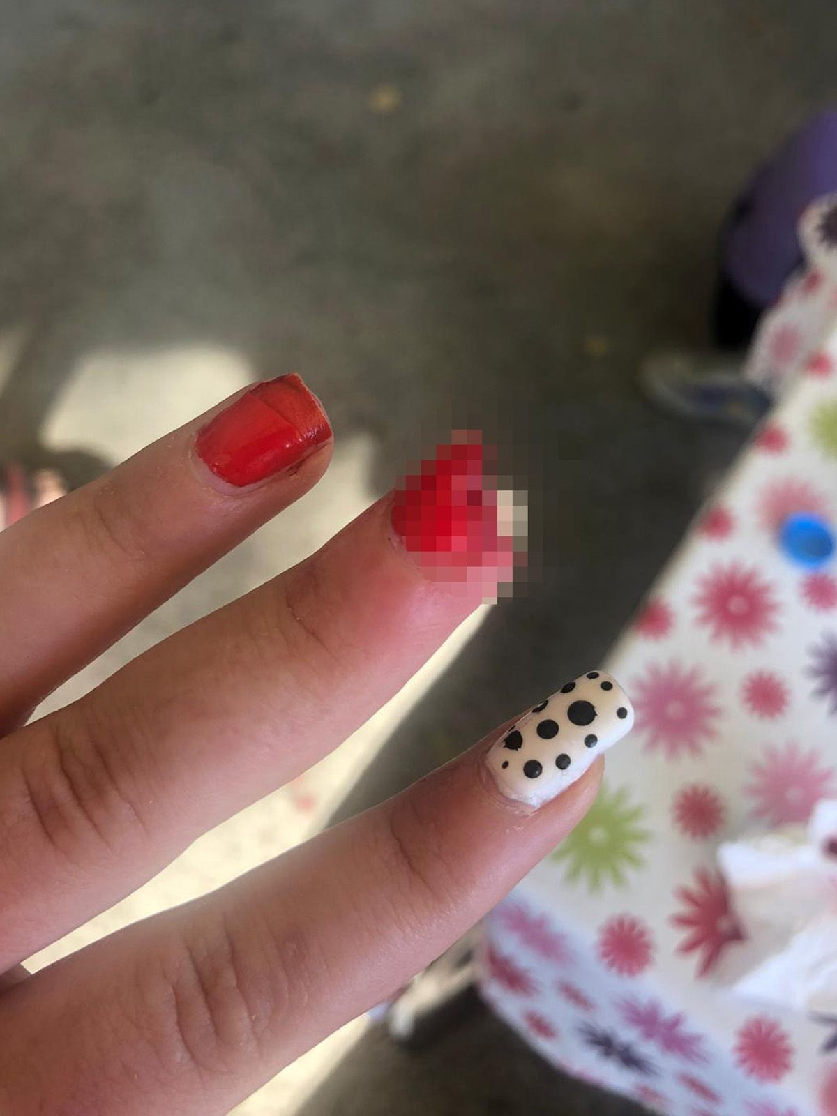 Yemek yemek için gittiği köftecide dehşeti yaşadı! - Sayfa 5