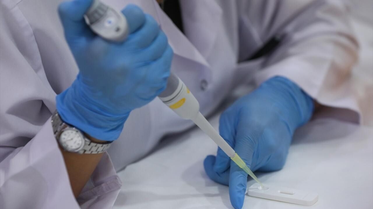 Yerli antikor testine yoğun talep! - Sayfa 6