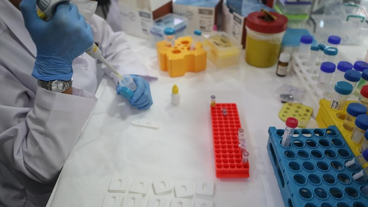 Yerli antikor testine yoğun talep! - Sayfa 7