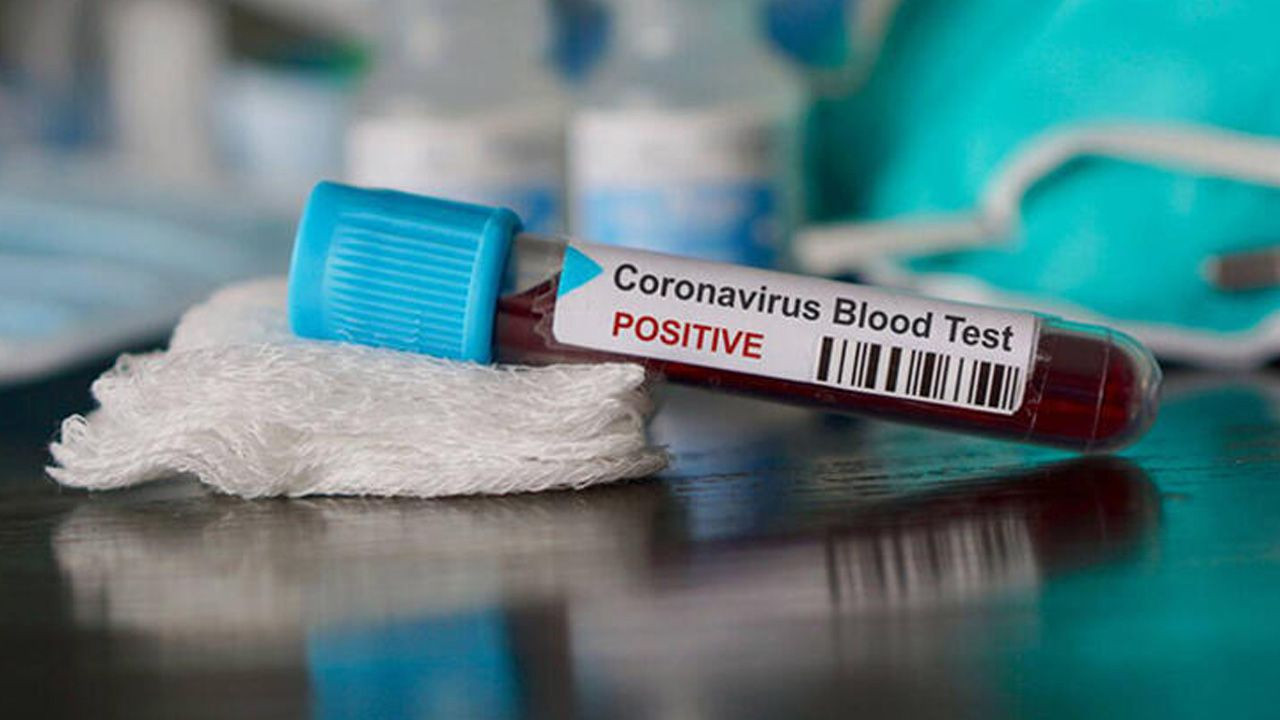 Koronavirüs ile gribi birbirinden ayırt etmenin yolu - Sayfa 10