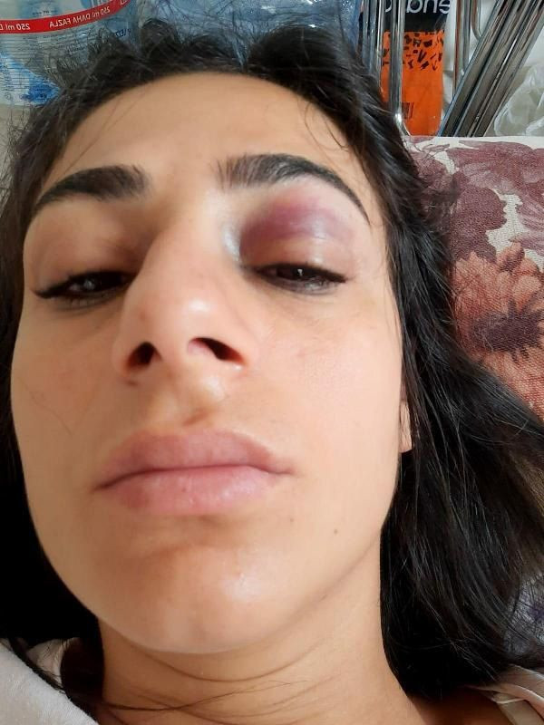 Sokak ortasında taciz edildi... Karşı koyunca tekme tokat dövüldü! - Sayfa 6