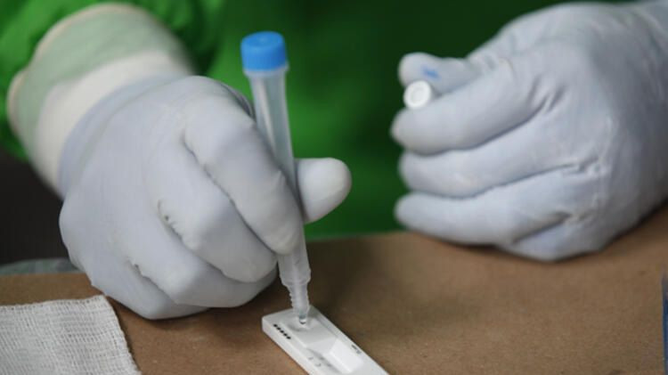 Teşhis için çok önemli deyip uyardı! - Sayfa 6