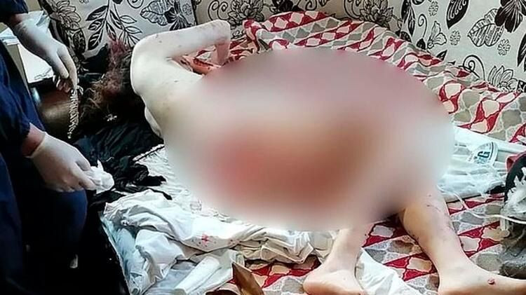 20 yaşındaki Rus güzellik uzmanı vahşi köpeklerin saldırısına uğradı! - Sayfa 8