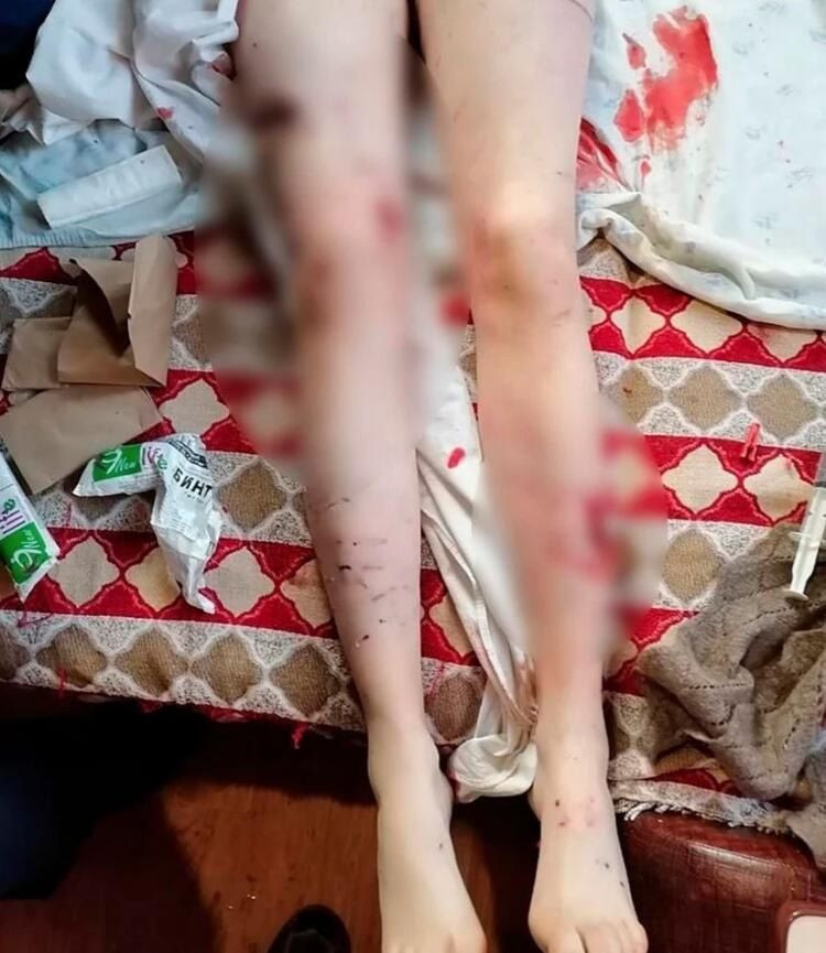 20 yaşındaki Rus güzellik uzmanı vahşi köpeklerin saldırısına uğradı! - Sayfa 9