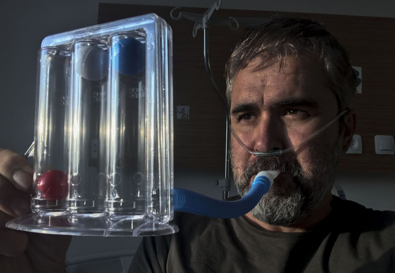 26 günlük Kovid işkencesini fotoğraflarla anlattı - Sayfa 16