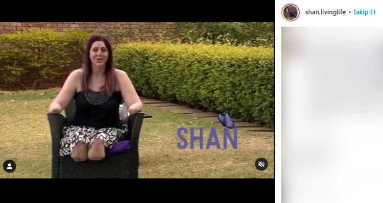 Fare ısırdı hayatı kabusa döndü! Burnu, dudakları, bacakları ve kolları kesildi... - Sayfa 9