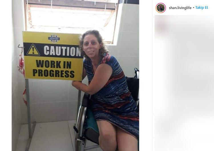 Fare ısırdı hayatı kabusa döndü! Burnu, dudakları, bacakları ve kolları kesildi... - Sayfa 11