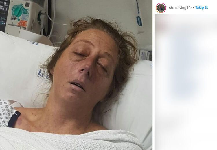 Fare ısırdı hayatı kabusa döndü! Burnu, dudakları, bacakları ve kolları kesildi... - Sayfa 5