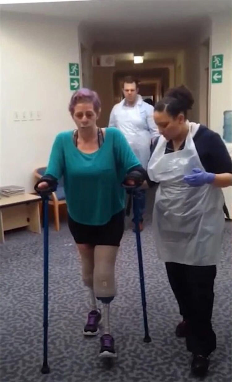 Fare ısırdı hayatı kabusa döndü! Burnu, dudakları, bacakları ve kolları kesildi... - Sayfa 13