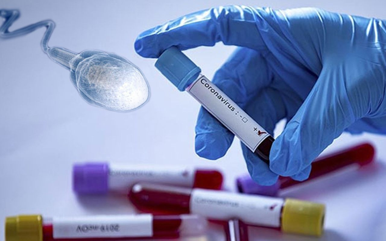 Koronavirüsün korkutan etkisi: Erkeklerde kısırlık yapıyor! - Sayfa 5