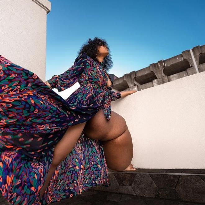 Bacaklarından biri 45 kilo! Fil hastalığı olan genç kadın kendiyle barışmayı öğrendi... - Sayfa 9