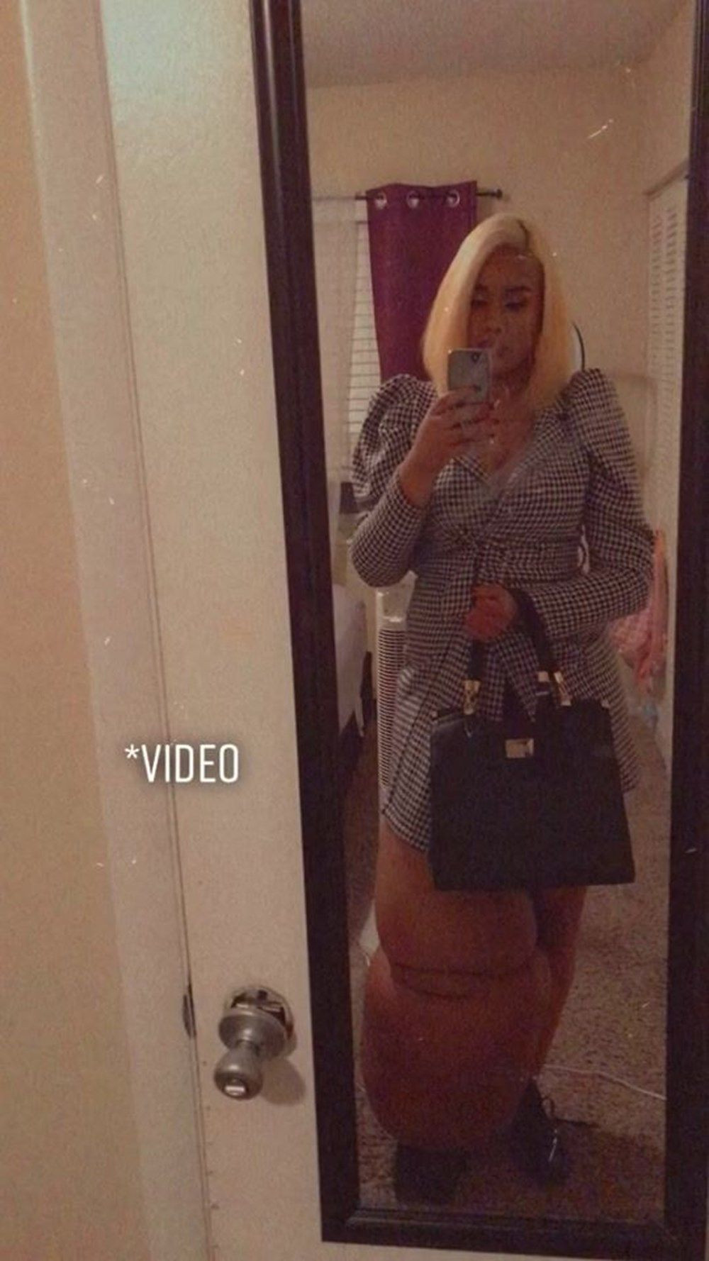 Bacaklarından biri 45 kilo! Fil hastalığı olan genç kadın kendiyle barışmayı öğrendi... - Sayfa 6