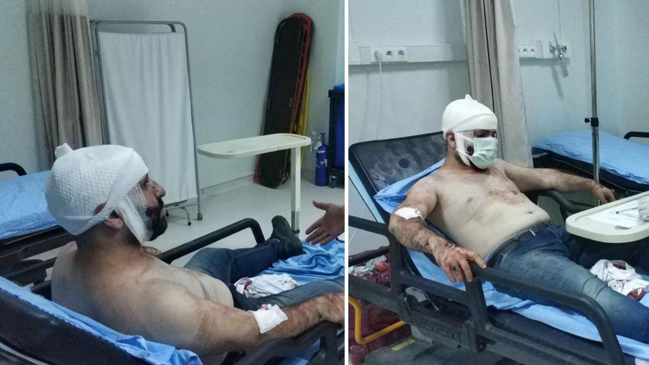 Sosyal medyada tanıştığı kız yüzünden hastanelik oldu! - Sayfa 8