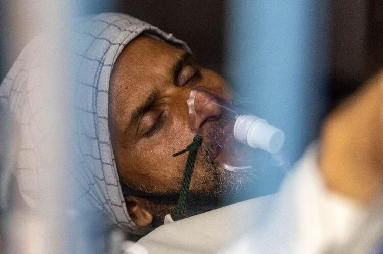 Kara mantar ameliyatından tüyler ürperten görüntüler: Gözler böyle oyuluyor... - Sayfa 9