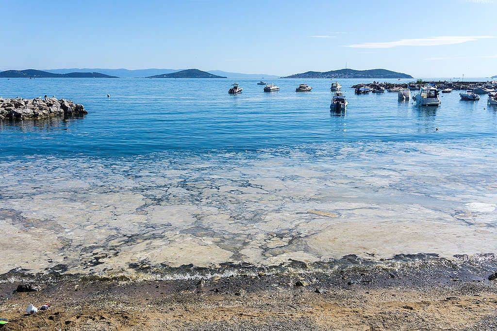 "Marmara obez oldu şeker komasına girdi" - Sayfa 11