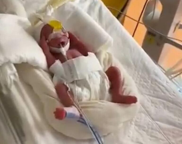 Karnını gören inanamadı! Tam 10 çocuk doğurdu... - Sayfa 6