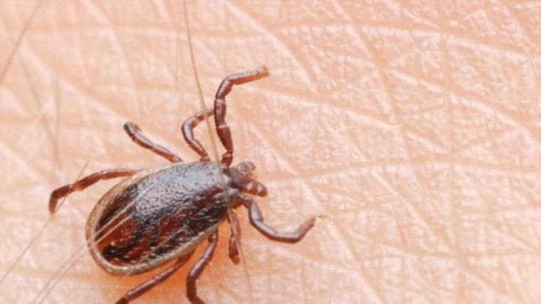 Bunu sakın yapmayın! Kene ısırıklarında hayati önem taşıyor - Sayfa 5