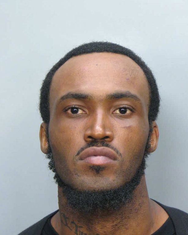 Böyle canilik görülmedi: Yamyam, evsiz adamın canlı canlı suratını yedi! - Sayfa 6