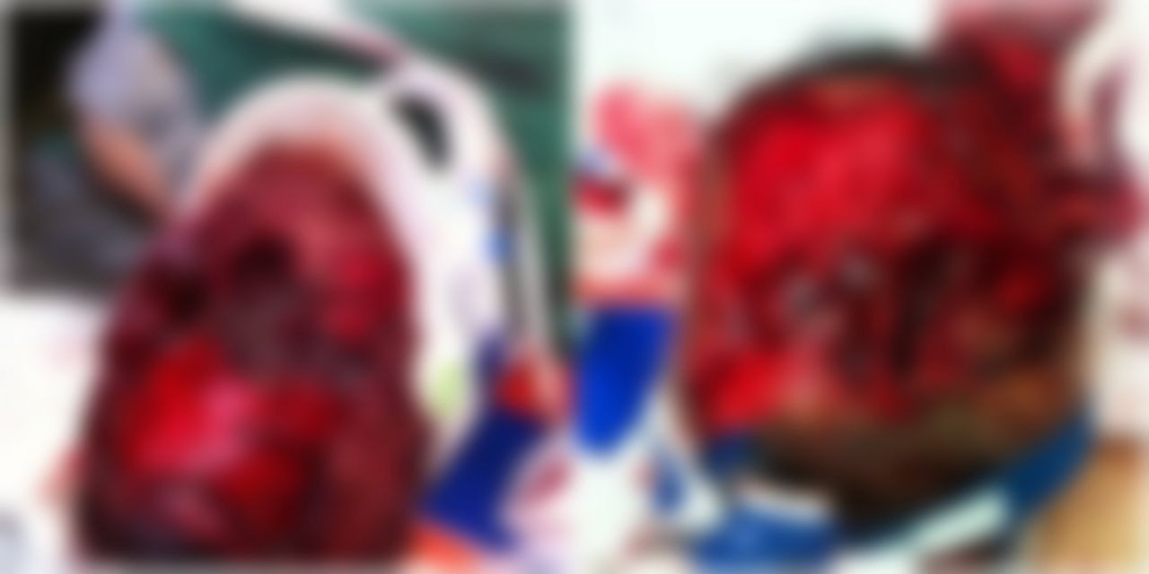 Böyle canilik görülmedi: Yamyam, evsiz adamın canlı canlı suratını yedi! - Sayfa 9