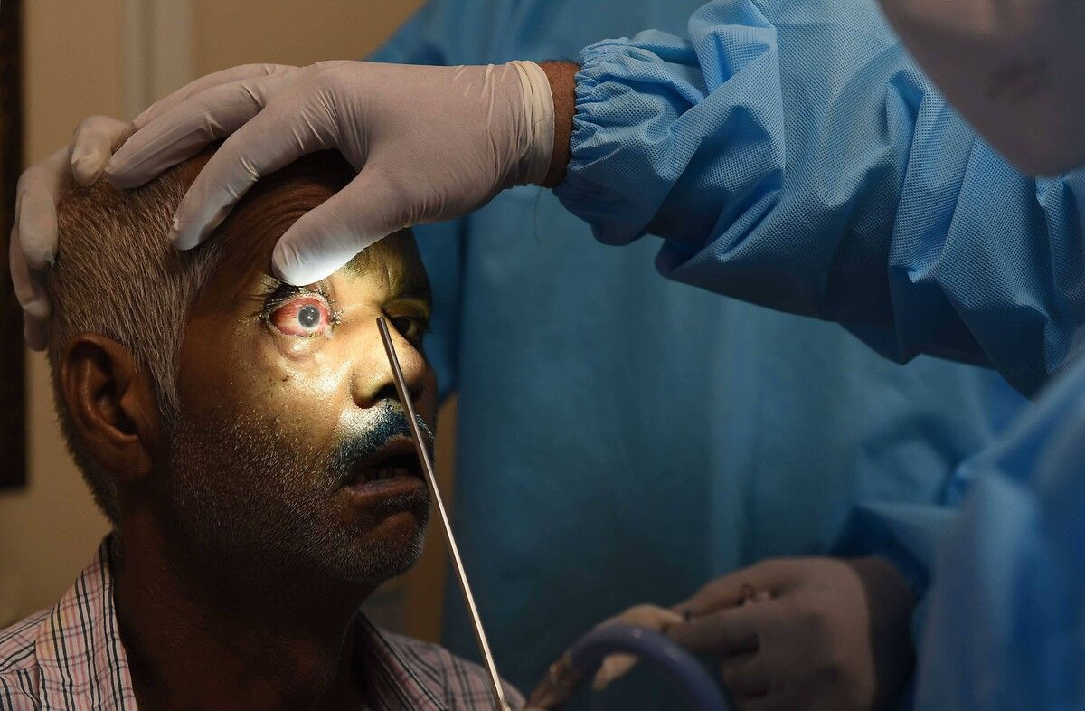 Hindistan'da ortaya çıkan 'kara mantar' hastalığı Umman'dan sonra Arjantin'de de görüldü - Sayfa 15