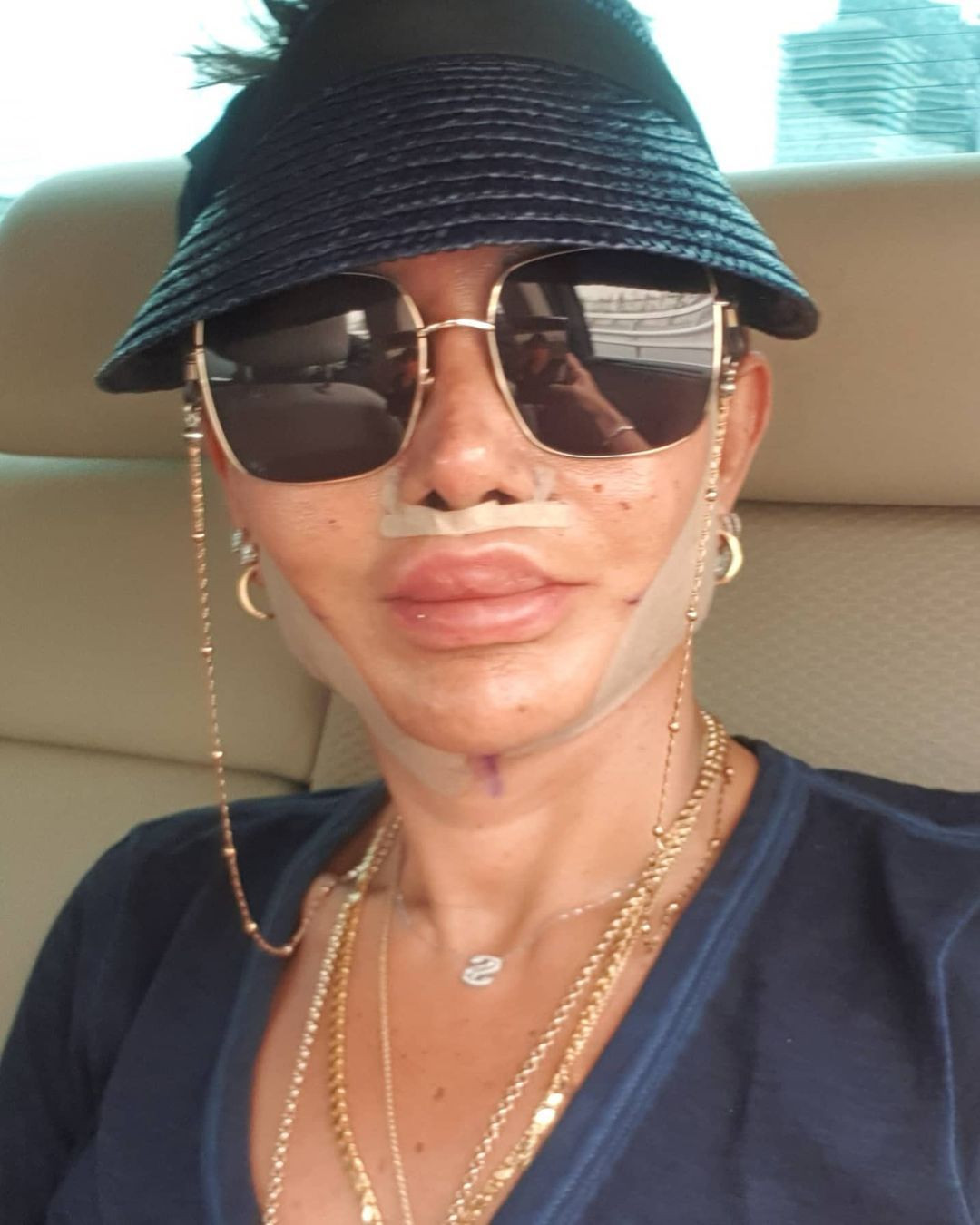 Serap Paköz'ün inanılmaz değişimi! Estetik sonrası son halini paylaştı - Sayfa 6