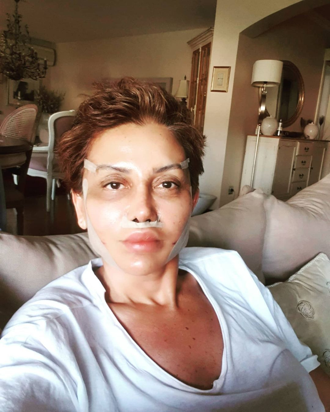 Serap Paköz'ün inanılmaz değişimi! Estetik sonrası son halini paylaştı - Sayfa 5