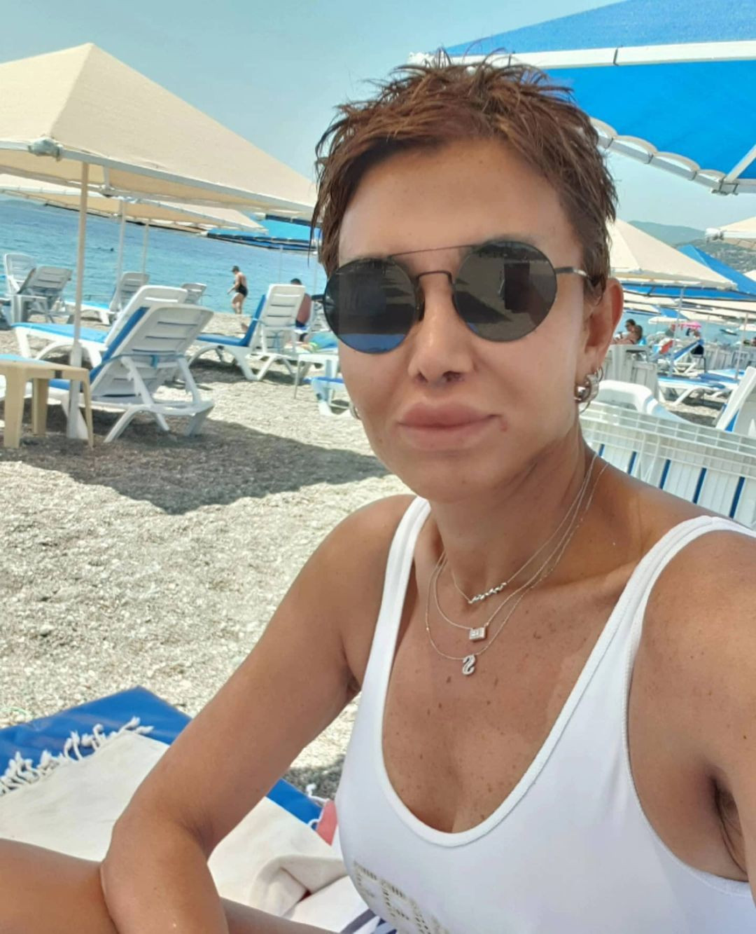 Serap Paköz'ün inanılmaz değişimi! Estetik sonrası son halini paylaştı - Sayfa 11