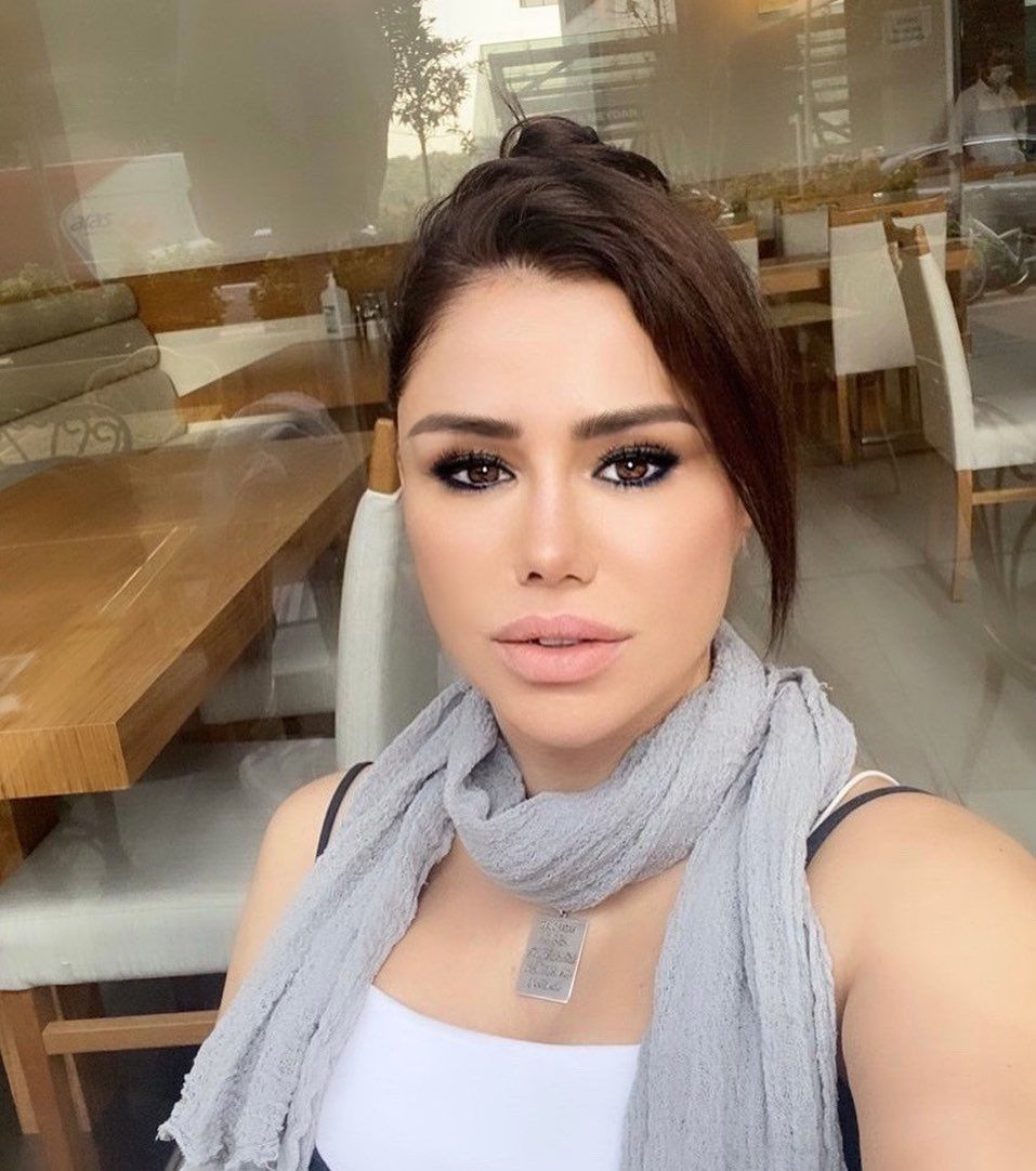 Küçük Ceylan'ın eski halinden eser kalmadı! Estetikle tanınmaz hale geldi - Sayfa 13