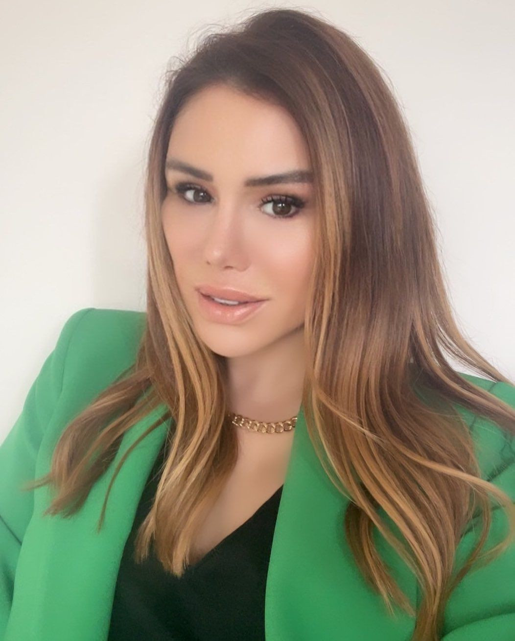 Küçük Ceylan'ın eski halinden eser kalmadı! Estetikle tanınmaz hale geldi - Sayfa 12