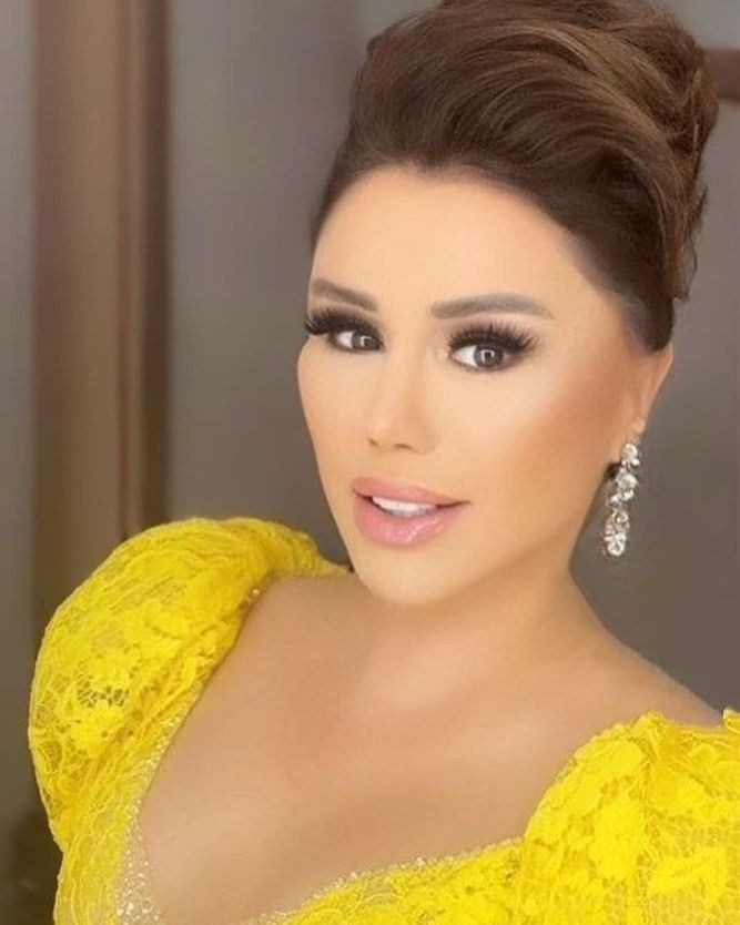 Küçük Ceylan'ın eski halinden eser kalmadı! Estetikle tanınmaz hale geldi - Sayfa 28