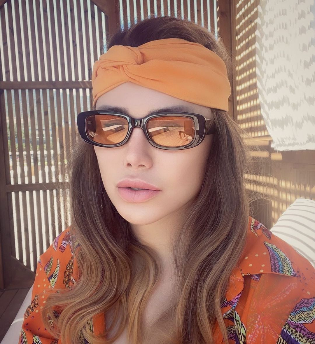 Küçük Ceylan'ın eski halinden eser kalmadı! Şarkıcı Ceylan estetikle kendisini öyle bir değiştirdi ki... - Sayfa 18