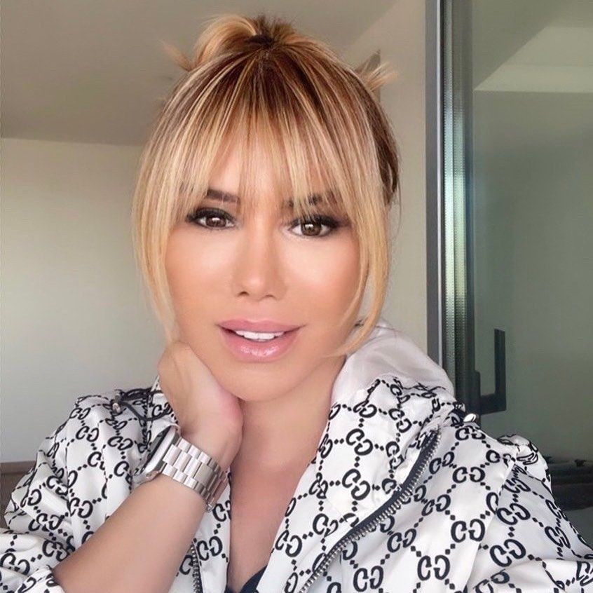 Küçük Ceylan'ın eski halinden eser kalmadı! Şarkıcı Ceylan estetikle kendisini öyle bir değiştirdi ki... - Sayfa 9