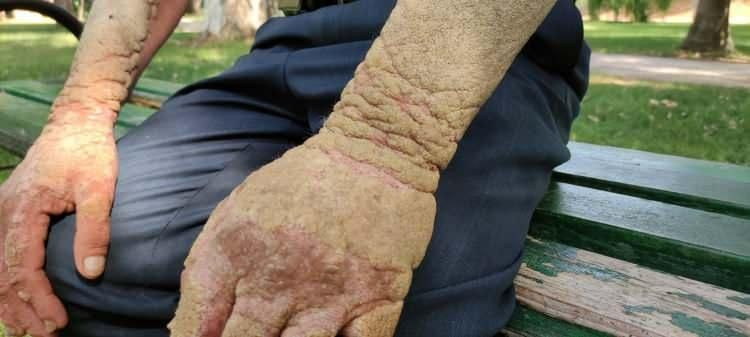 23 yıl önce bir sabah uyandığında neye uğradığını şaşırdı! "Beni gören hızlıca kaçıyor" - Sayfa 6