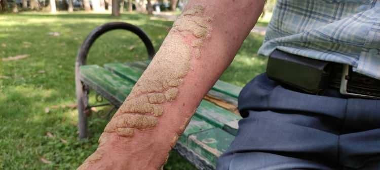 23 yıl önce bir sabah uyandığında neye uğradığını şaşırdı! "Beni gören hızlıca kaçıyor" - Sayfa 8