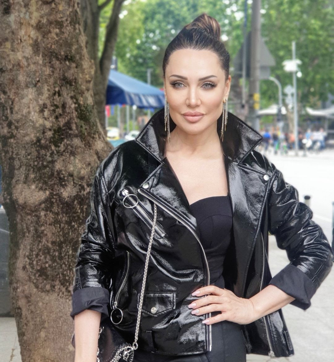 Türkiye'nin Angelina Jolie'si Umut Akyürek estetiği abarttı! Gün geçtikçe gençleşiyor - Sayfa 22