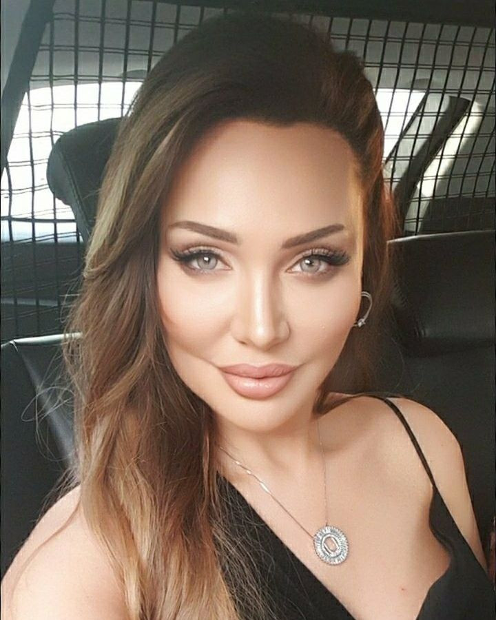 Türkiye'nin Angelina Jolie'si Umut Akyürek estetiği abarttı! Gün geçtikçe gençleşiyor - Sayfa 27