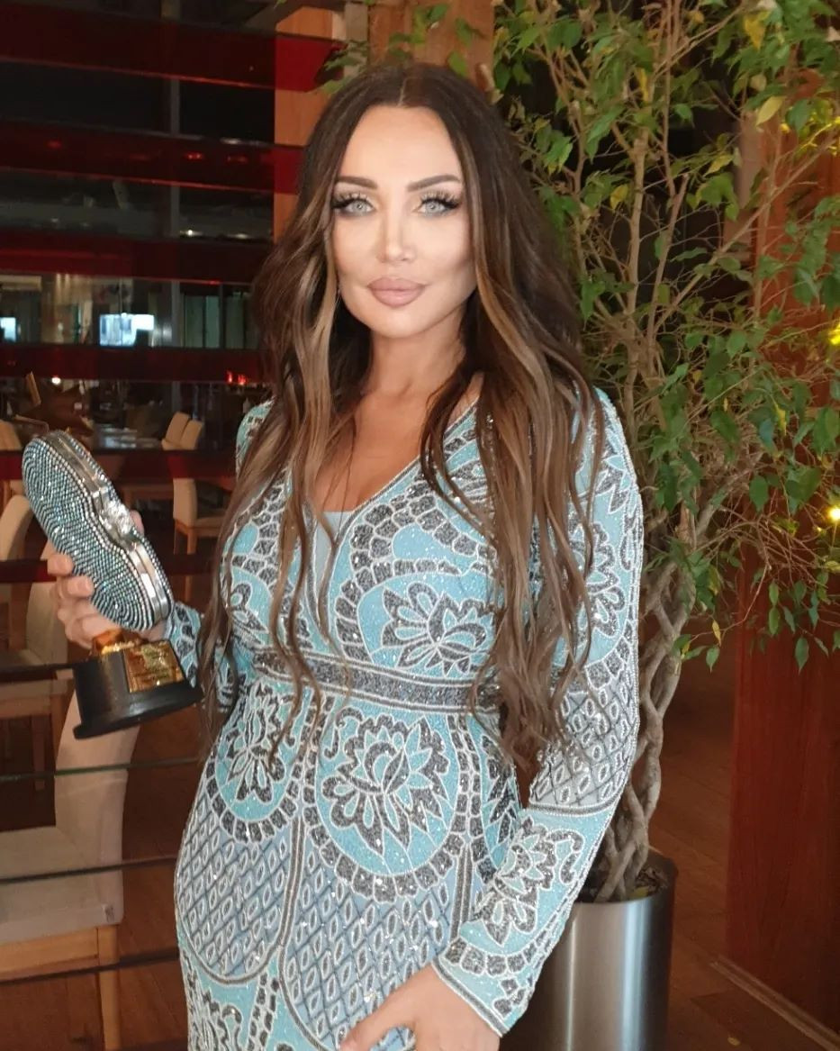 Türkiye'nin Angelina Jolie'si Umut Akyürek estetiği abarttı! Gün geçtikçe gençleşiyor - Sayfa 35