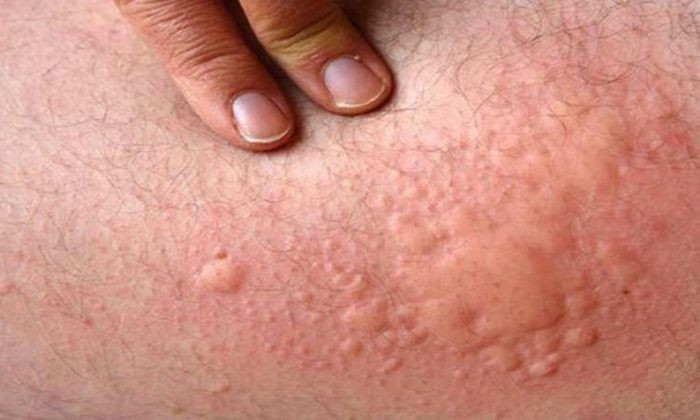 Koronavirüs sonrası sakın bunu yapmayın! Her yeriniz böyle olabilir... - Sayfa 6