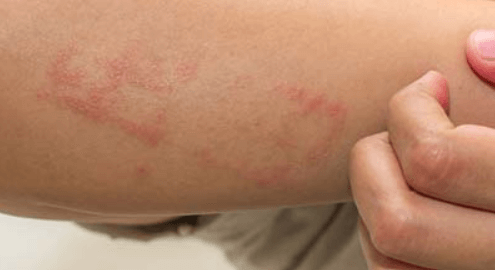 Koronavirüs sonrası sakın bunu yapmayın! Her yeriniz böyle olabilir... - Sayfa 7