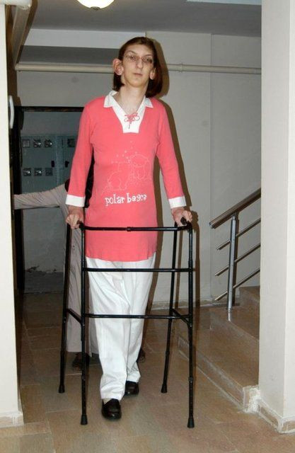 Dünyanın en uzun erkeğinin ardından en uzun kadını da Türkiye'den! 24 yaşındaki Rümeysa'nın boyu tam 2 metre 15 cm - Sayfa 12