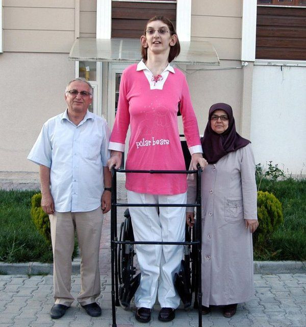 Dünyanın en uzun erkeğinin ardından en uzun kadını da Türkiye'den! 24 yaşındaki Rümeysa'nın boyu tam 2 metre 15 cm - Sayfa 8
