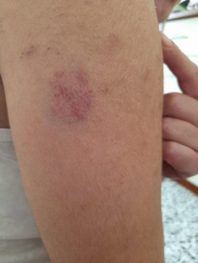 Kayseri'de Rus bakıcı 83 yaşındaki kadına kabusu yaşattı: Tuvaletini yapmaması için günlerce aç bırakmış! - Sayfa 5