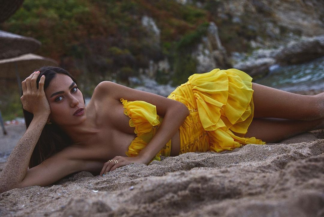 Kırgın Çiçekler'in Meral'i estetikle bambaşka biri oldu! Aleyna Solaker evrim geçirdi - Sayfa 24