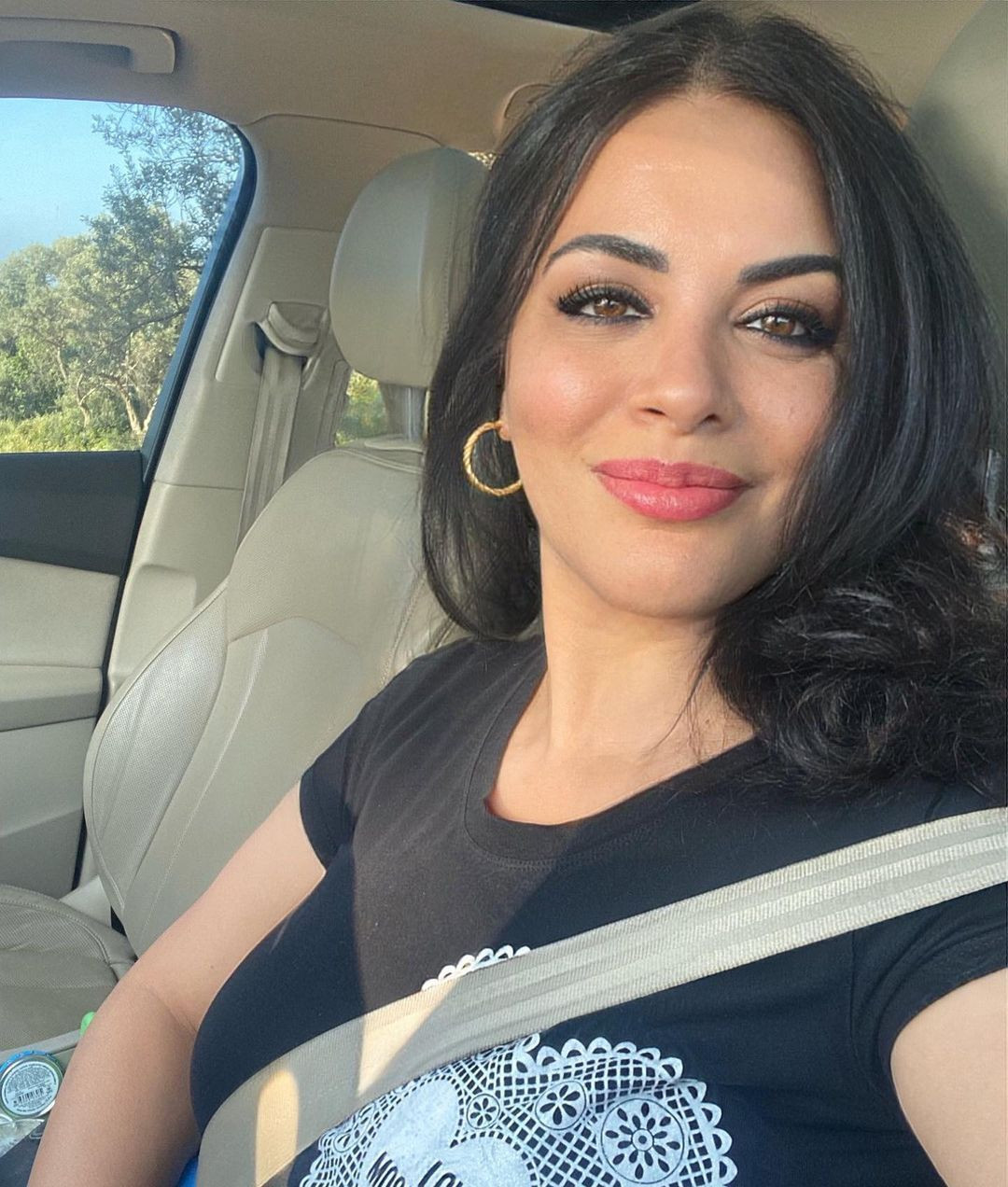 Estetikle bambaşka biri oldu! İşte şarkıcı Zara'nın yıllar içindeki değişimi... - Sayfa 8