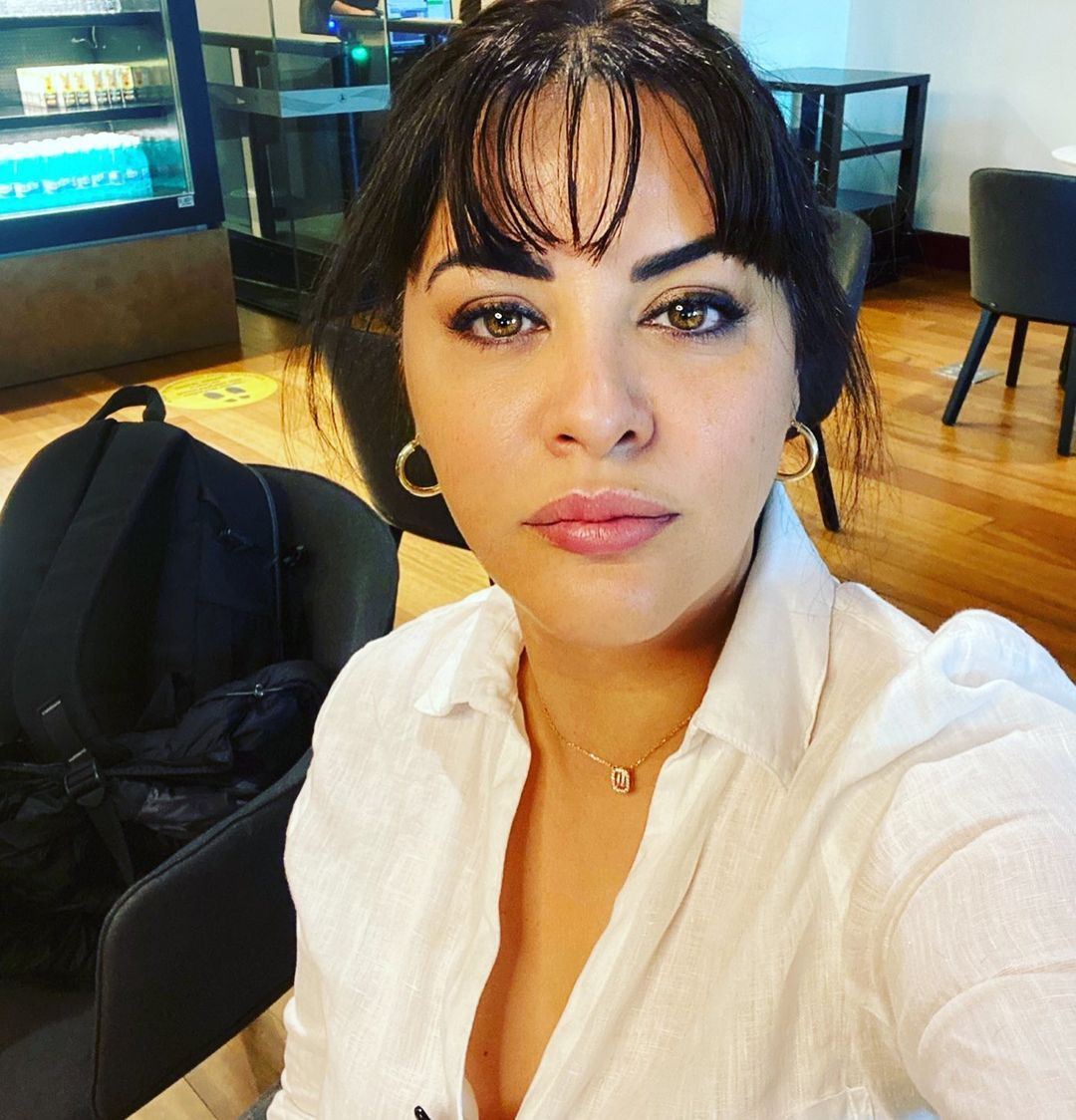 Estetikle bambaşka biri oldu! İşte şarkıcı Zara'nın yıllar içindeki değişimi... - Sayfa 22