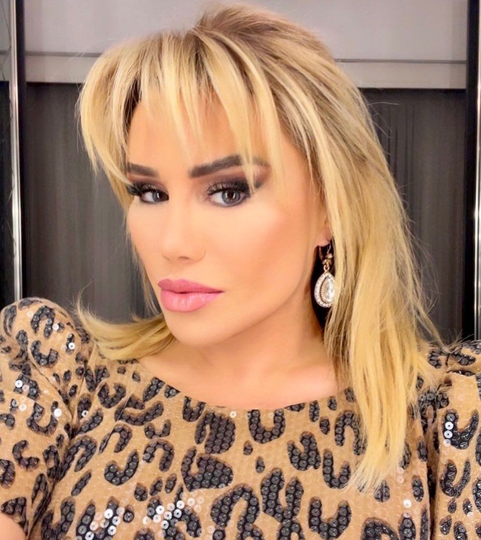 Küçük Ceylan'ın eski halinden eser kalmadı! Şarkıcı Ceylan estetikle kendisini öyle bir değiştirdi ki... - Sayfa 22